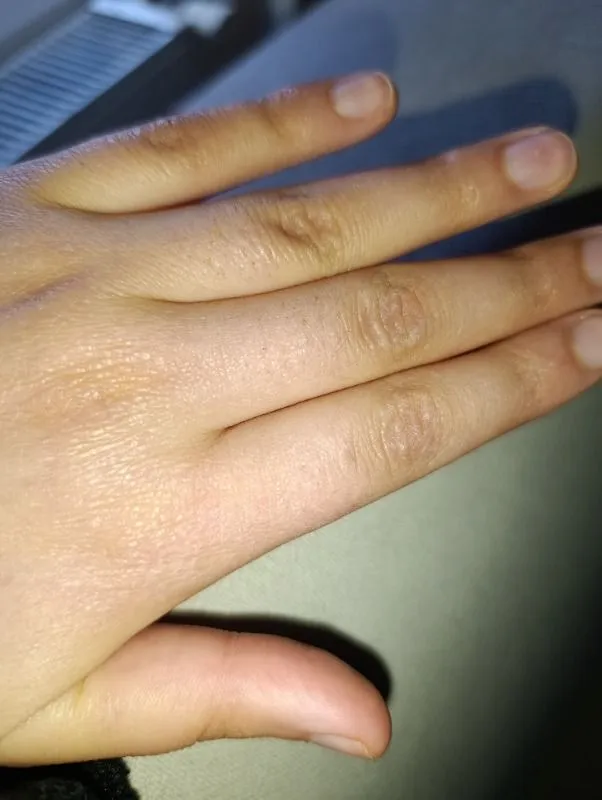 Yui IPLV15 Pro Vücut -Yüz- Bikini Başlıklı Ağrısız Otomatik ve Manuel Atım Buz Lazer Epilasyon Cihazı