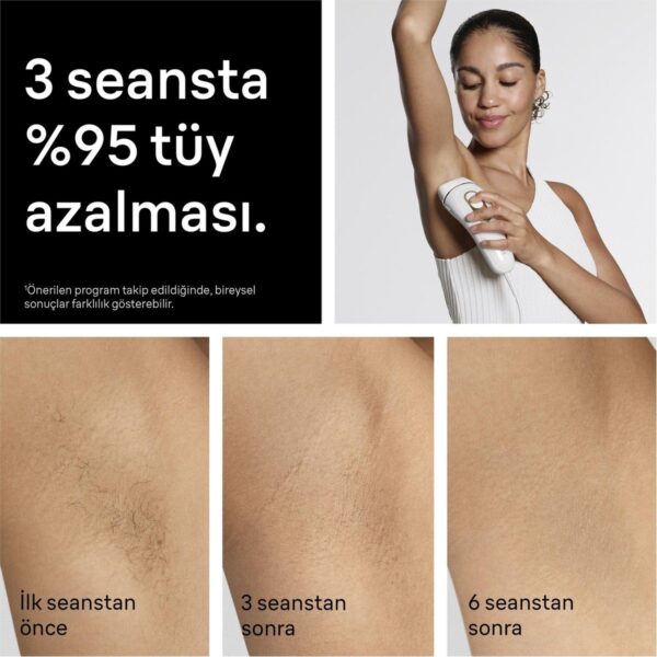 Braun Ipl Silk·expert Pro 5 Beyaz Kablolu IPL Cihazı, Cilt Temas Sensörü ve 3 Başlık ile Etkili Tüy Alma PL5311